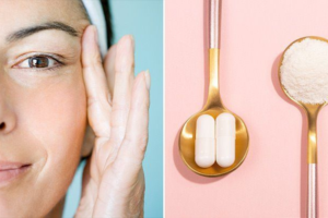 Collagen