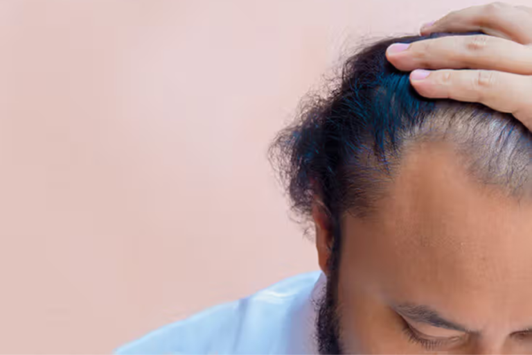 Hair Growth Supplements