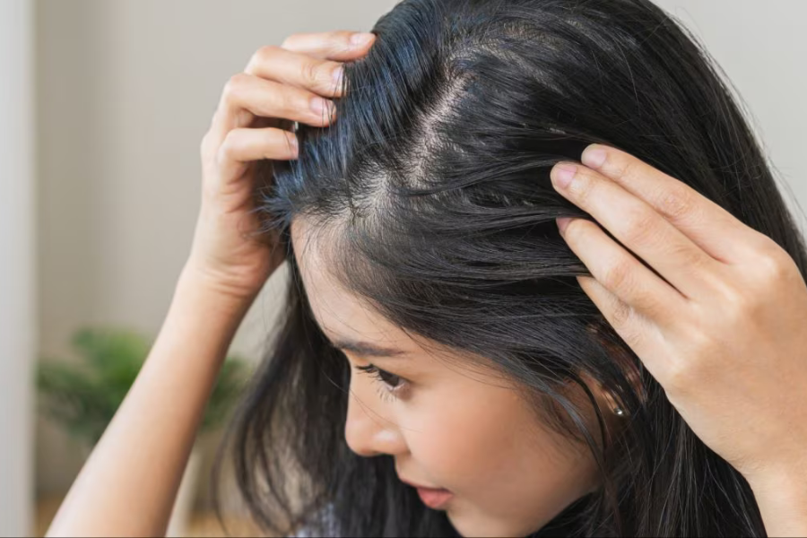 Hair Growth Supplements